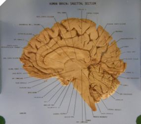 A sagittal section of a human brain. Click this image for a high-res version in which you can read the annotations.